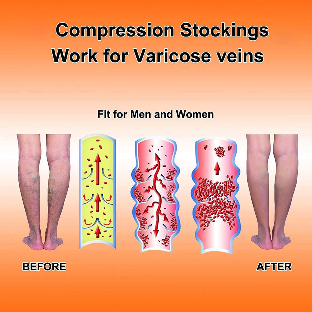 Medical Calf Compression Sleeve 30-40mmhg Men Women